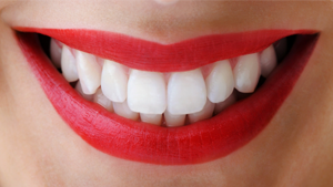 Estetica dental