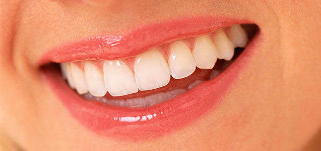 Tipos de blanqueamiento dental