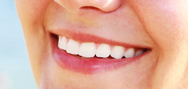 Blanqueamiento dental, mitos y verdades