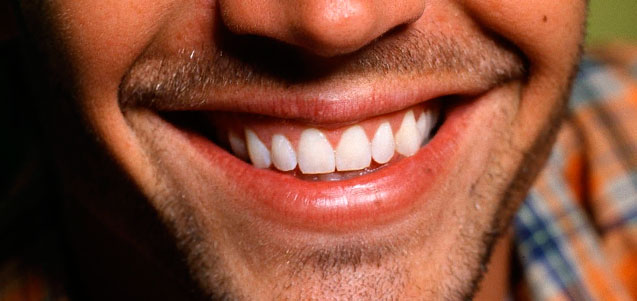 Ponerse un Implante dental. ¿Marca o Profesional?
