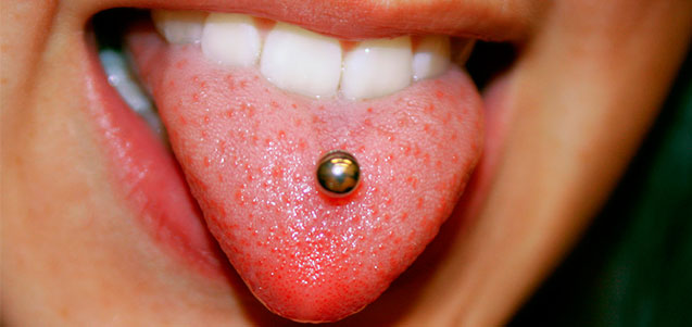 Piercings orales y salud bucodental