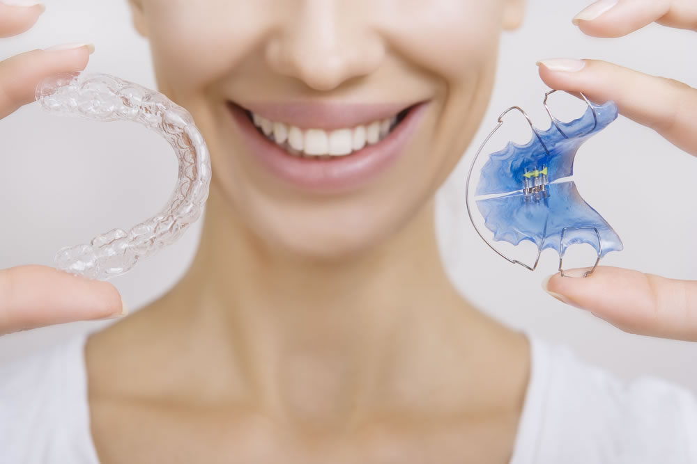 Invisalign o brackets Barcelona