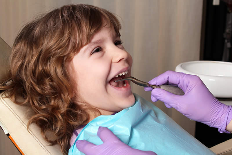 Causas caries dental
