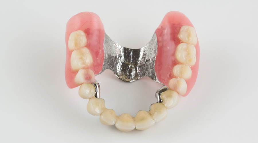 Protésis dentales y restauración provisional