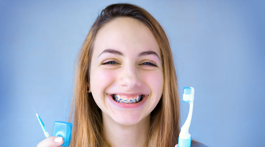 Brackets con retenedores