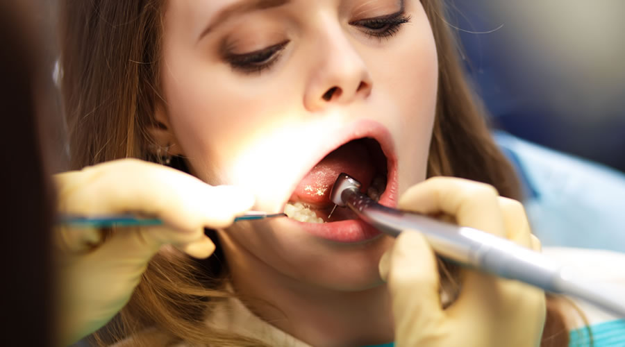 Reendodoncia en Barcelona